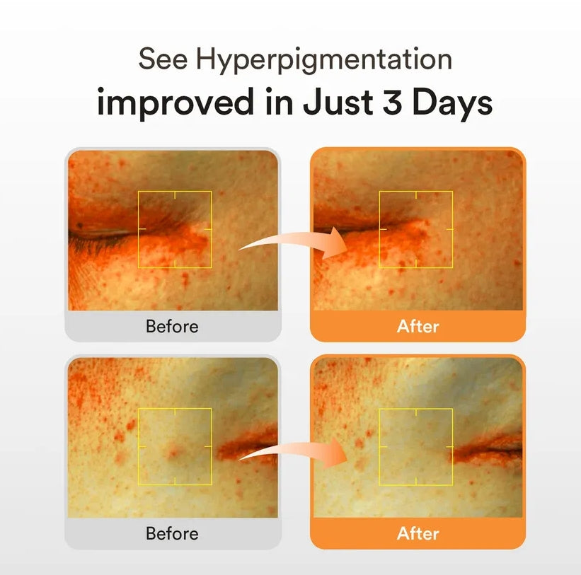 Abib - Glutathiosome Dark Spot Serum Vita Drop.