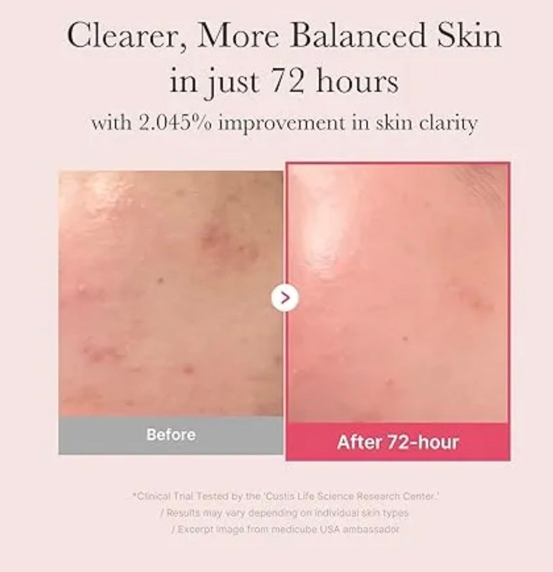 TXA Niacinamide 15 Serum
